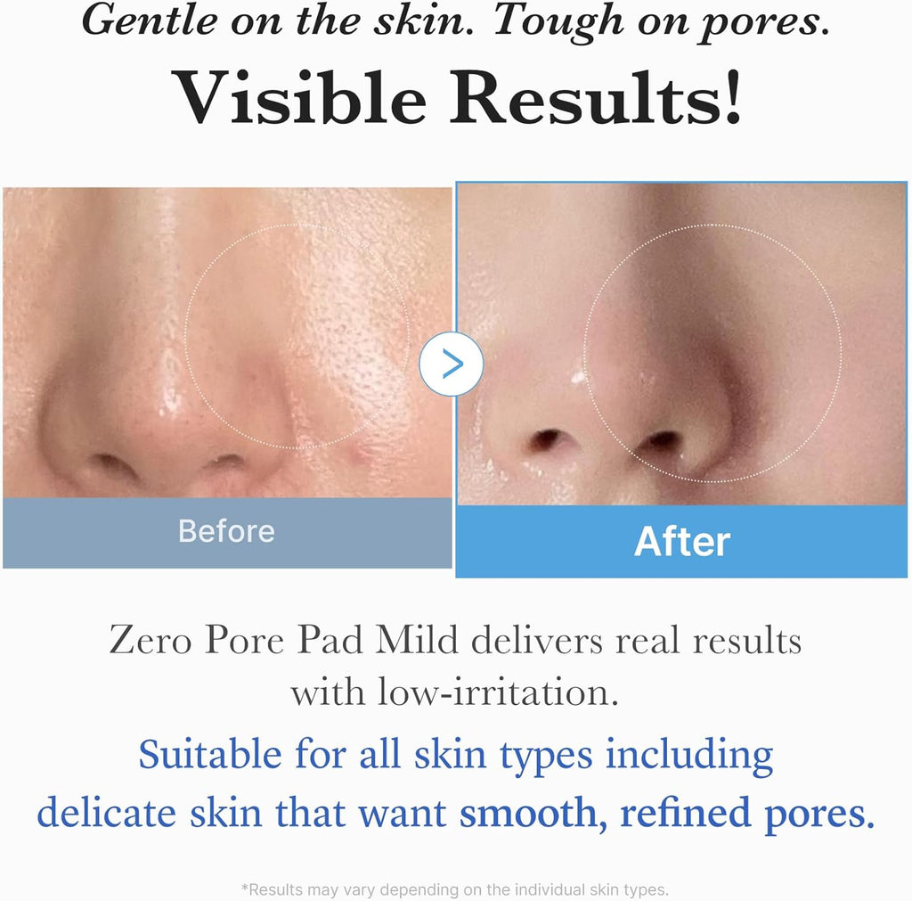 medicube Zero Pore Pads Mild 2.0- Gentle Calming Toner Pads
